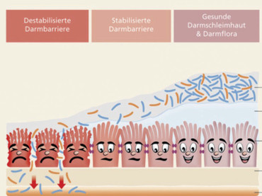 Neue Einblicke in die Darmbarriere: Darm undicht? So wichtig ist unsere innere Schutzmauer Neue Einblicke in die Darmbarriere: Darm undicht? So wichtig ist unsere innere Schutzmauer